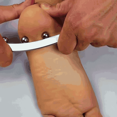 Applying the Step Therapy pressure tool to a mapped point